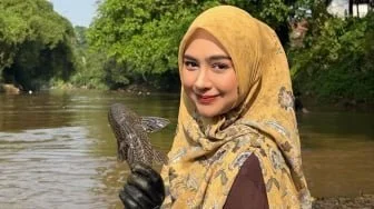 Dihujat, Ria Ricis Jelaskan Oplas Hidung karena Lelah Pakai Obat