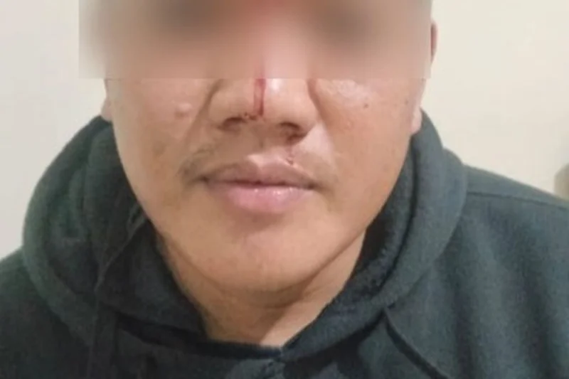 Kronologi Guru SD Balikpapan Dikeroyok Usai Tegur Siswa Merokok, Korban Malah Minta Maaf