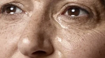 7 Tanda Kulit Rusak Akibat Tidak Memakai Sunscreen secara Rutin
