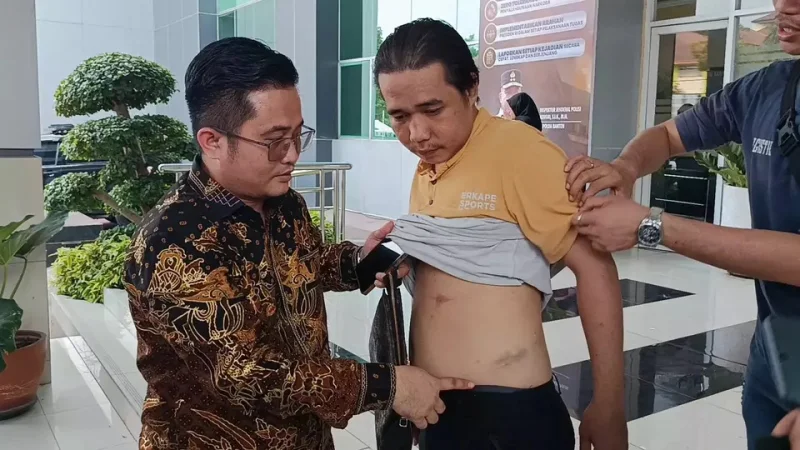 Ajukan Resign, Karyawan Bank Keliling di Tangerang Malah Disiksa