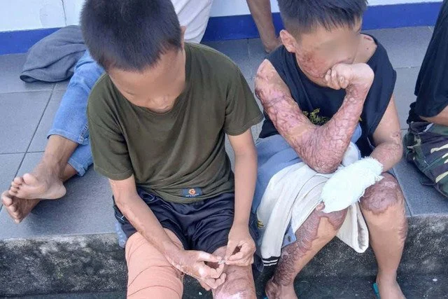 Sakit, Pimpinan Ponpes Tersangka Pembakaran Santri di Lombok Belum Ditahan
