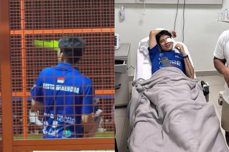Detik-detik Mata Desta Kena Pukulan Bola Padel, Alami Pendarahan