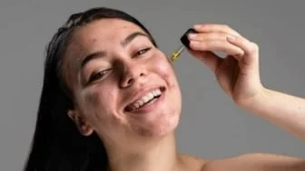 5 Rekomendasi Serum Jerawat Lokal, Lengkap dengan Review Jujur Pembeli